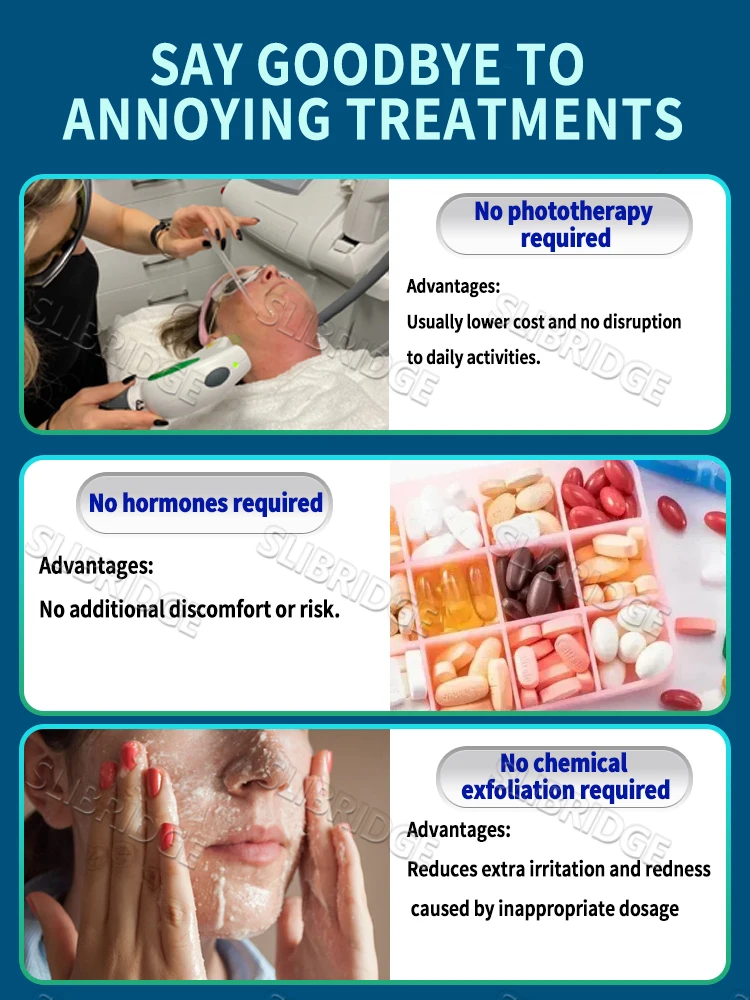 قلم الضوء الأزرق يحل التجاعيد، أدوات العناية بالبشرة التجاعيد، تهدئة التموج على البحيرة، شحن مجاني #3