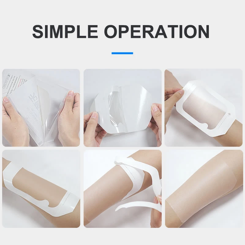 .Hot Sale-Waterproof Wound Bandage Adhesive Patches Transparent Film Dressing Post Infusion Indwelling Needle Fixing Paste 10Pcs