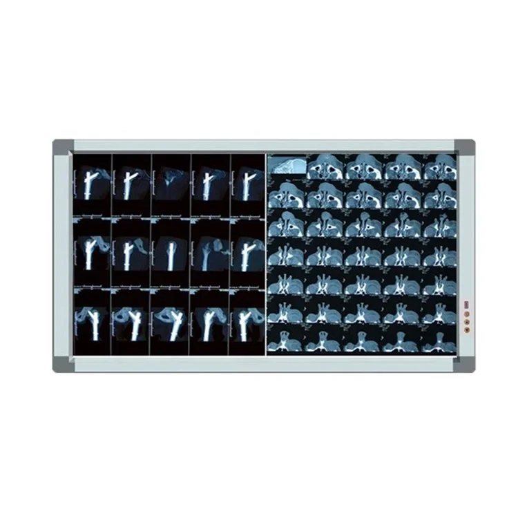 Double panel LED negatoscope X-ray Film Viewer Illuminator