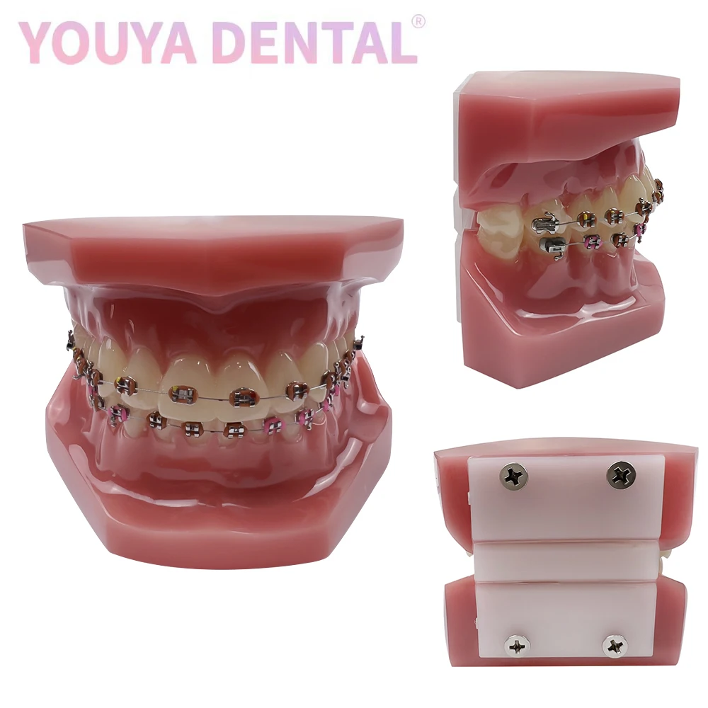 

Orthodontic Teeth Teaching Model All Metal Orthodontic Model for Dentist Technician Practice Training Studying