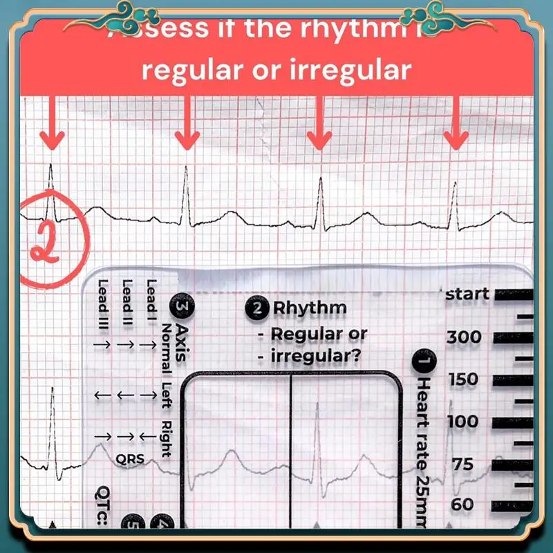 (Новинка) - Шаговая линейка ЭКГ 7, шаговая линейка ЭКГ для перевода ЭКГ/ЭКГ, инструмент для быстрого и быстрого анализа кардиологического анализа и измерения