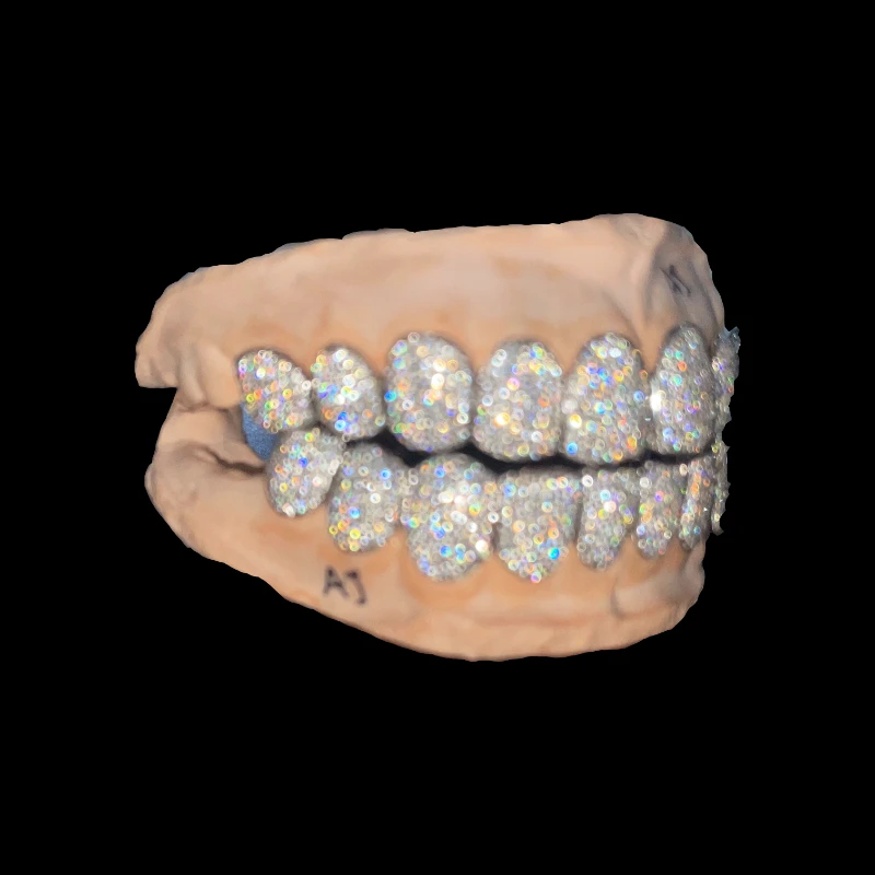 Grillz Dental de oro moissanita VVS, parrillas de plata esterlina 925, hechas a medida, estilo Hip Hop