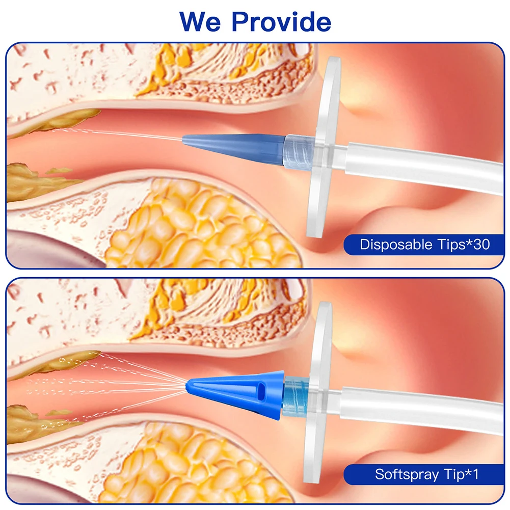 Medicals Grade Ear Syringes Kit Manual Ear Wax Removal Cleaner Ear Irrigation Flushing System Earwax Remover Kit Healthy Care