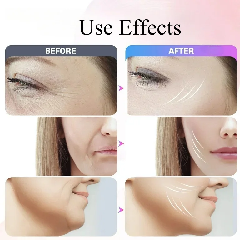 المكتبة الذكية T منتج التجميل الكهربائية ماجيك إصبع مدلك جهاز مكركرنت الإصبع الذهبي لشد الوجه #4