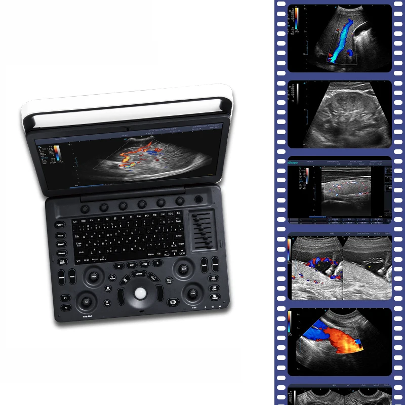 Products subject to negotiationUltrasound Scanner Cardiac Vascular Color Doppler Sonoscape E2 E3