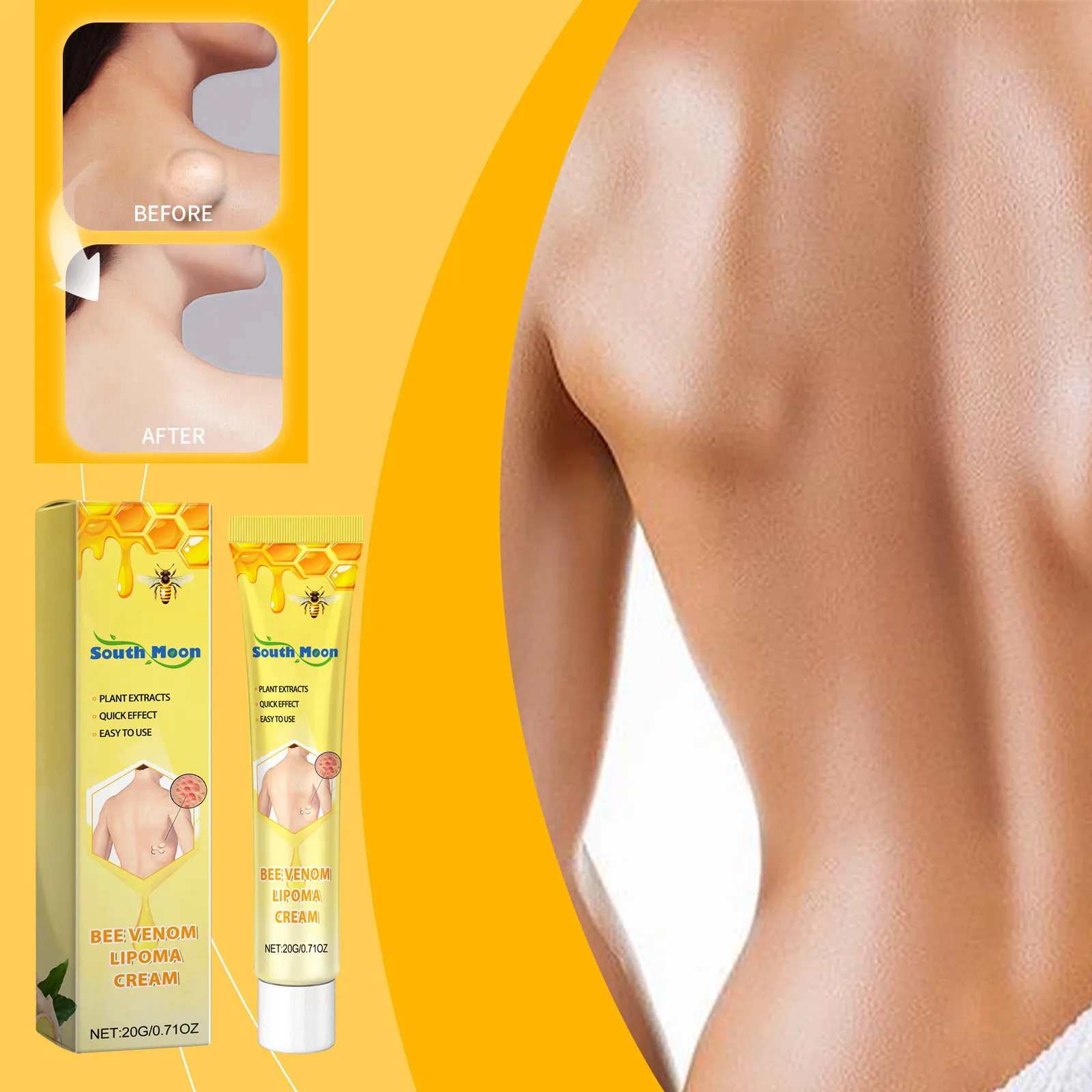 Bee Venom Lipoma Removal Cream Lymphatic Detox Health Care Anti Swelling Neck Armpit Breast Skin Lymph Node Treatment Ointment