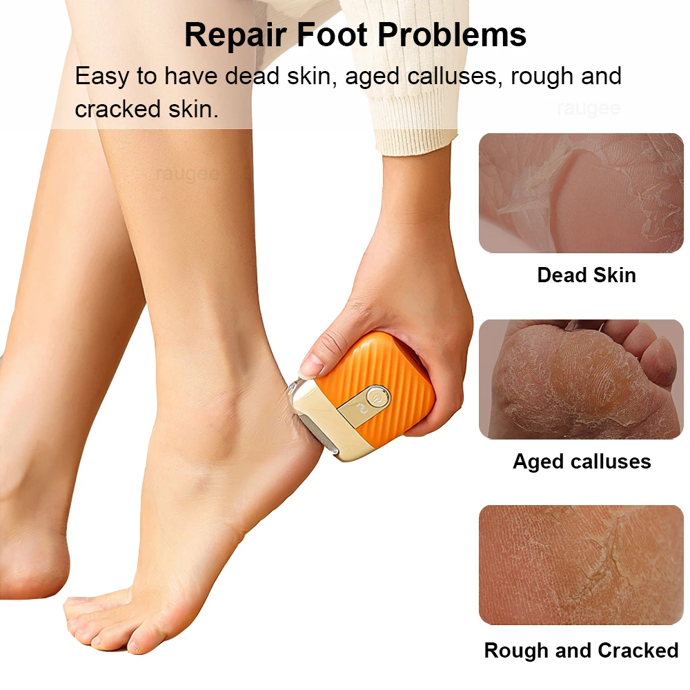 Electric Foot Grinder Portable Electric Callus Remover for Feet Foot Exfoliation Sander Rechargeable Electric Foot File Pedicure