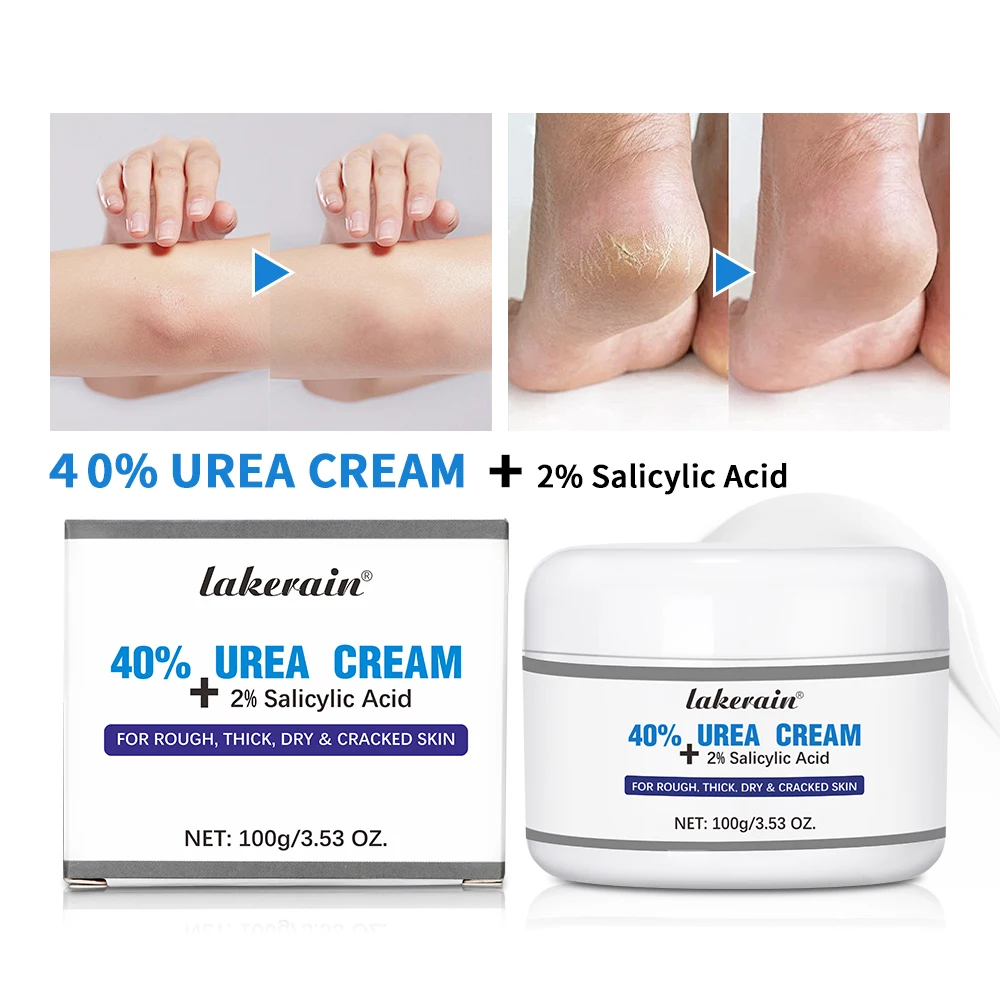 40% Urea Cream+ 2% Salicylic Acid Cracked Foot Cream With Urea for Feet Foot Dead Skin Remover Things for Skincare Remove Feet C