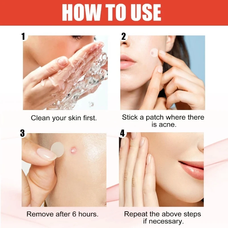 Mighty Patch Original Adesivo para Acne, Adesivos Hidrocoloides para Espinhas no Rosto, Adesivos Noturnos para Manchas na Pele do Rosto em 1 Aplicação
