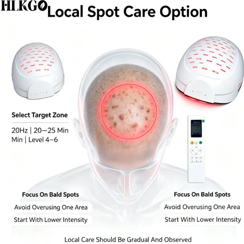 Professional 300 Laser Cap LLLT Therapy Hair Growth Helmet Hair Regrowth Support Superior Coverage Home Use