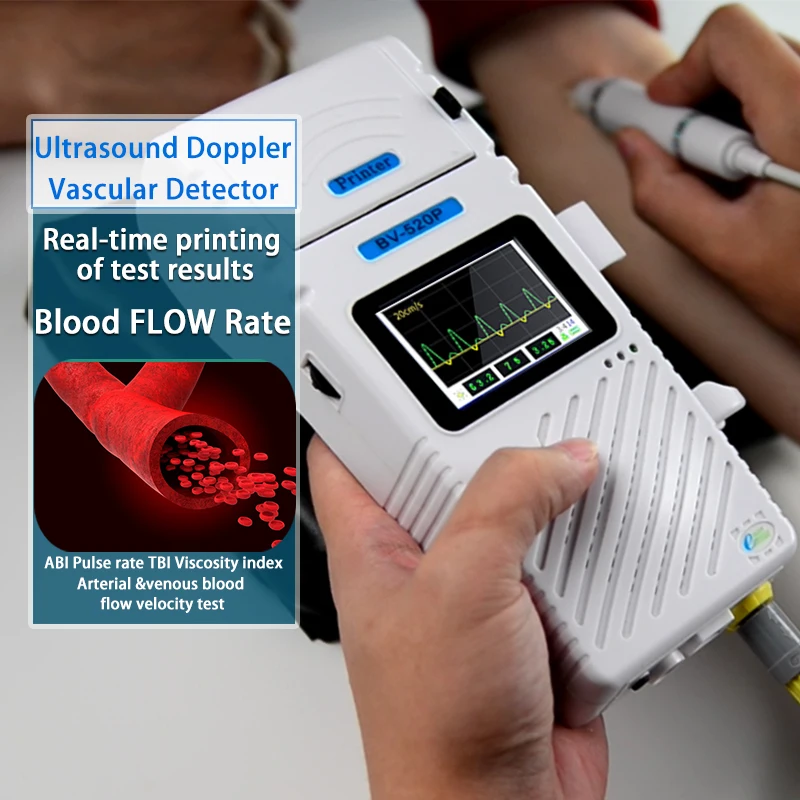 Blood Flow Velocity In Arteries&Veins Real-Time Waveform LCD Display &Integrated Printer Hand Held Bidirectional Pocket Doppler