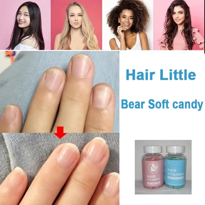 

1 Set of Hair Vitamin Gummies To Promote Hair Growth Regulate Endocrine System Improve Hair Health Supplement Nutrition