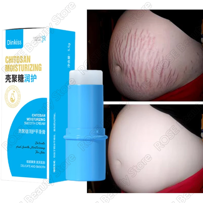 

Removes Stretch Mark Stick Cream Pregnant Women Repair Anti-Aging Anti-Winkles Cream Increase Elasticity Smooth Firm Skin Care