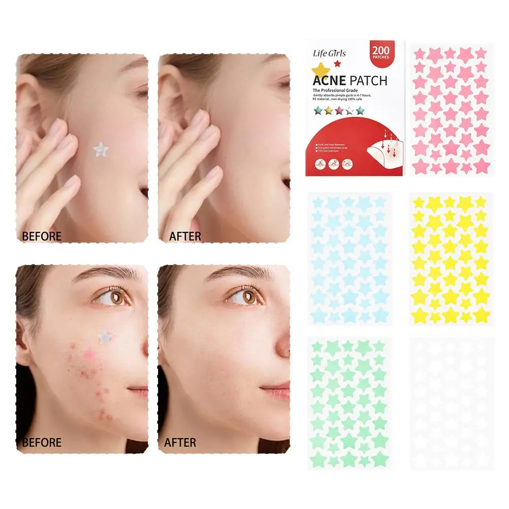 200 Pcs Star Acne Pimple Patches For Face Hydrocolloid Star Patches With Tea Tree Centella Oil Colorful Healing Stickers