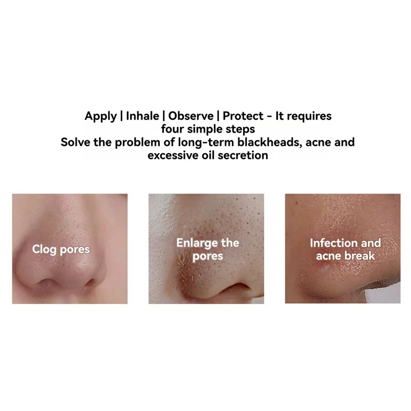 TCF-Visual Black Remover Macchina per la pulizia profonda del viso Punti neri e rimozione dell'acne Ventosa elettrica per punti neri riscaldata