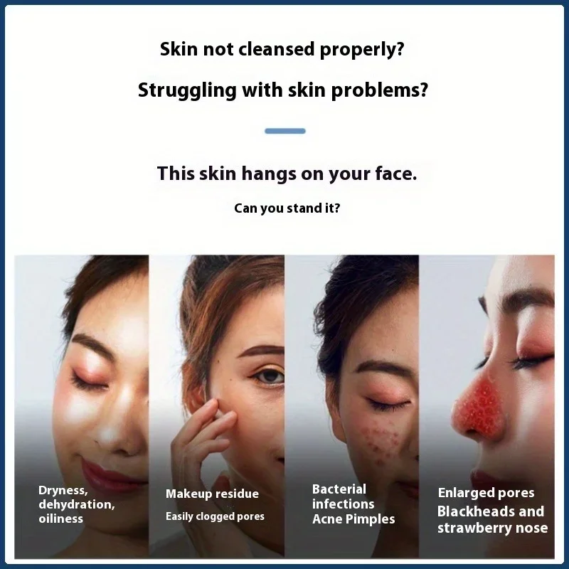 Elektrische mee-eter sucker poriënreiniger gezichtsreiniging schoonheidsinstrument acne poriën acne gezichtsverzorging schoonheidstools