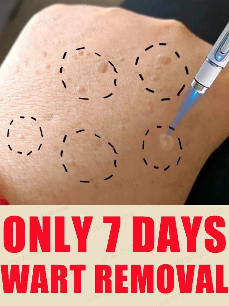 

2nd ᵍᵉⁿᵉʳᵃᵗⁱᵒⁿ ᵘᵖᵍʳᵃᵈᵉᵈ wᵃʳᵗ ⸴ ʳᵉpᵃⁱʳ wᵃʳᵗˢ ʳᵒoᵗ ⸴ ᑫᵘⁱᶜᵏˡʸ