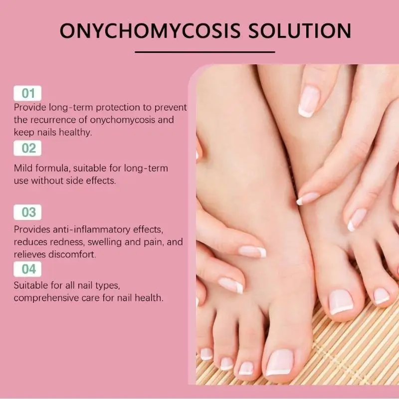 Zehennagel und Fingernägel für die Nägelwahrnehmung Flüssigkeit Mehrzwecknagelreparatur für verfärbte und beschädigte Nägel T4MB