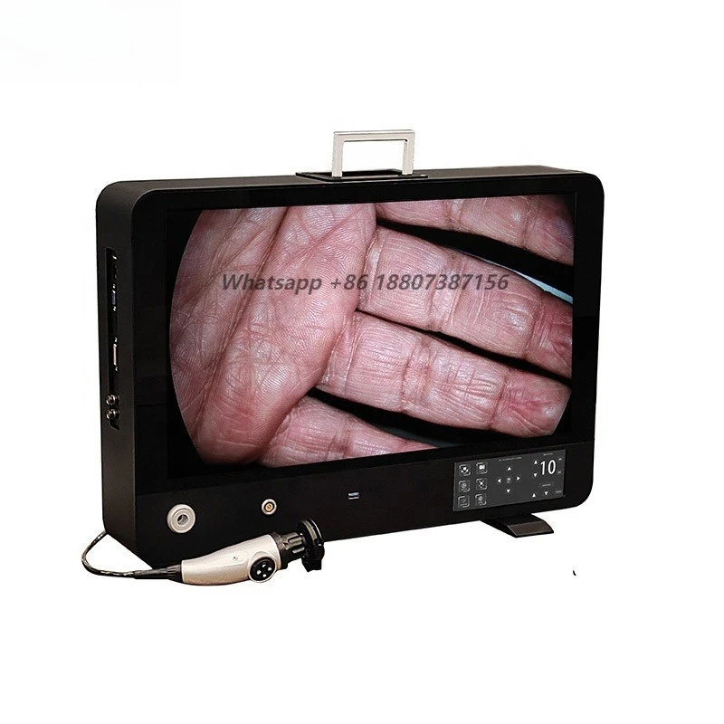 Portable veterinary endoscopic imaging device, endoscopic  system with high definition endoscopic  and LED lighting
