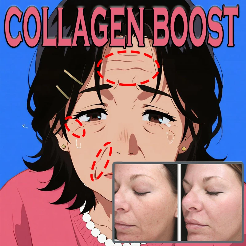 الكولاجين دفعة ثبات كريم ايسنس تتلاشى الخطوط الدقيقة الوجه اشراق الكولاجين الداعم البرق حمض الهيالورونيك العناية بالبشرة #1