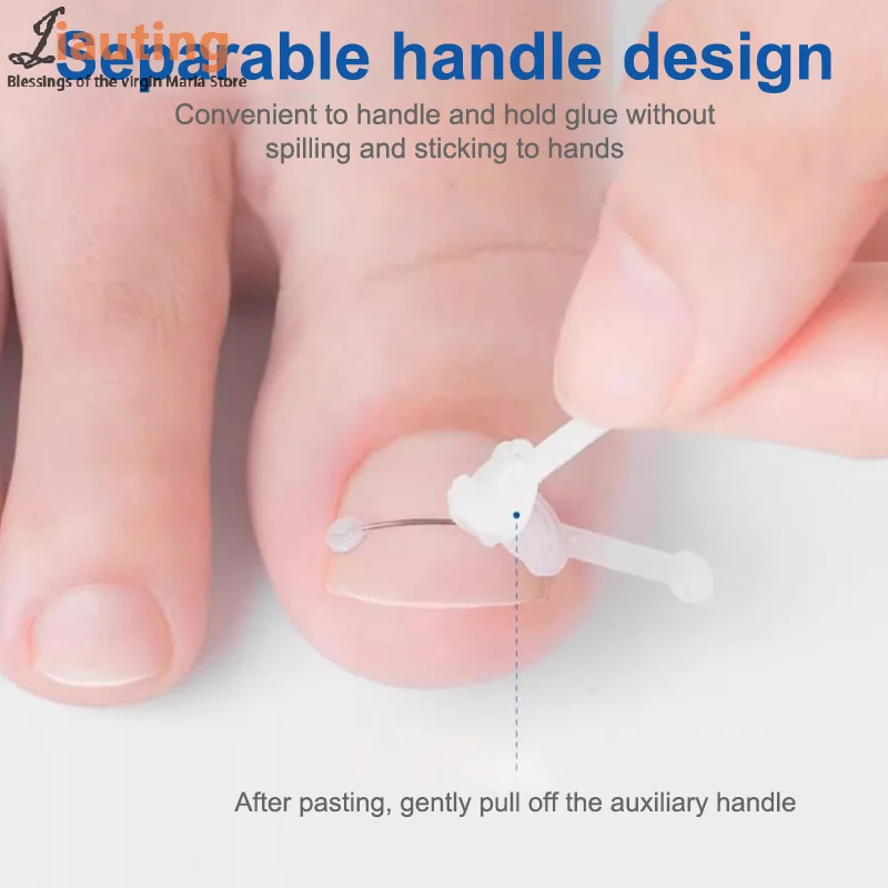 Hot Sale Ingrown Toenail Correction Tool Ingrown Toe Nail Treatment Elastic Patch Sticker Straightening Clip Brace Pedicure Tool