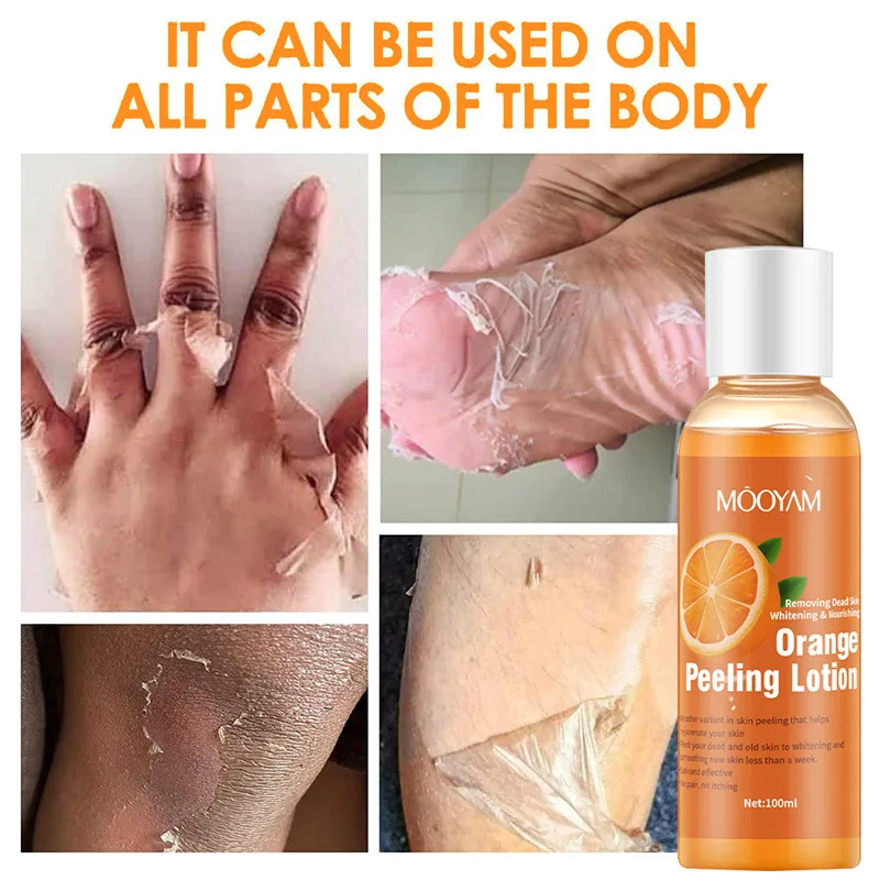 

Orange Peeling Lotion Body Whitening Exfoliating Lotion Gel Repair Knee Underarm Dark Skin Moisturizing Essence Exfoliating Oil