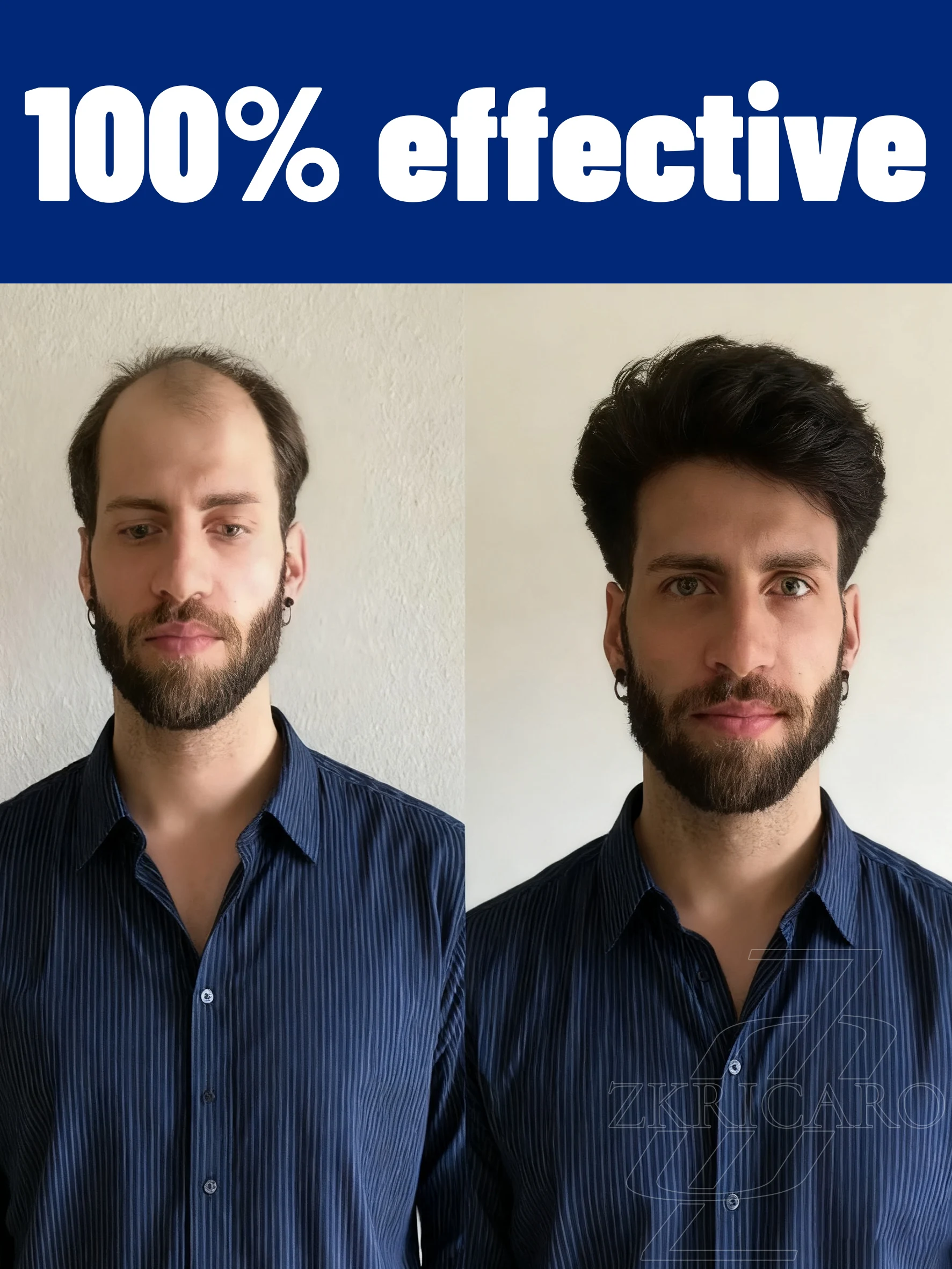 

LКонге aziв жизни и работе Lazi.