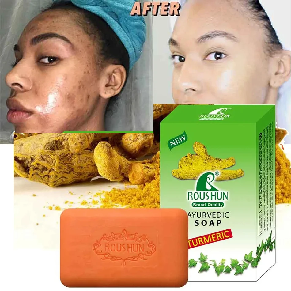 2Pcs Turmeric Soap Face Cleansing Anti Acne Whitening Skin Lightening Face Remove Pimples Dark Spots Lightening Handmade Soap