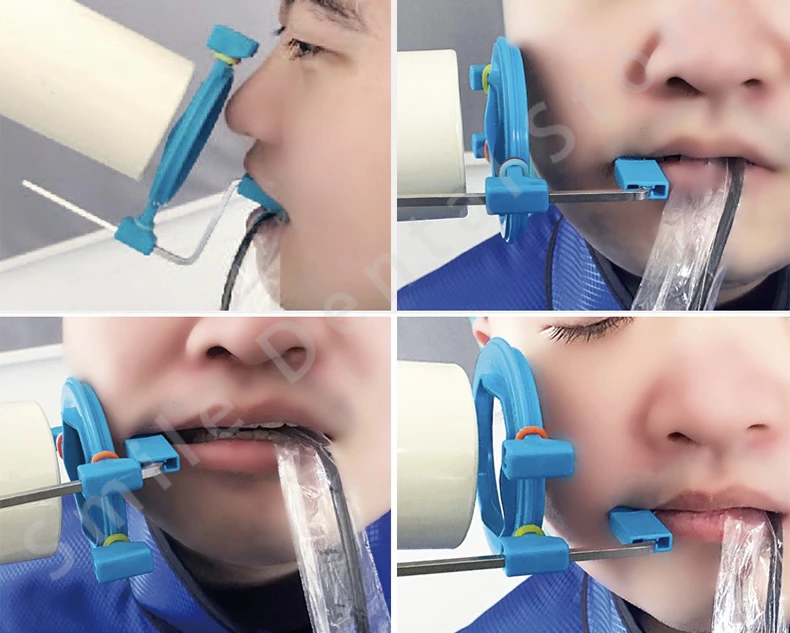 Dental X‑ray Film Sensor Positioning System Color‑Coded Aiming Ring Bite Block Autoclavable Instrument For Clinic Radiography