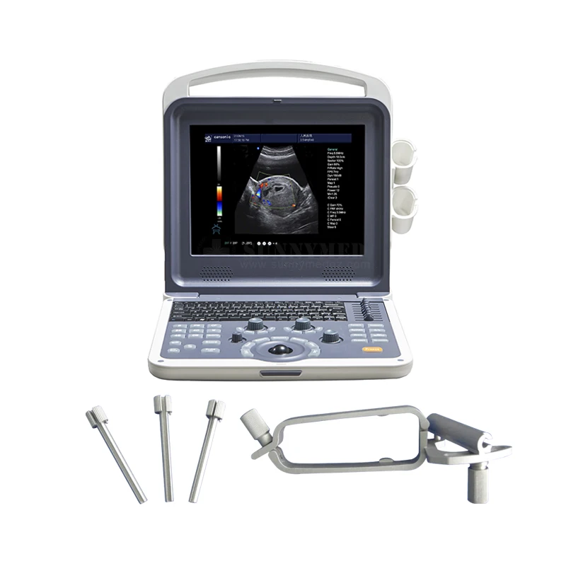 SY-A042N China Medical Portable Ultrasound Scanner Machine Price with 2 Probes Cheapest 4D Upgradable Laptop Color Doppler