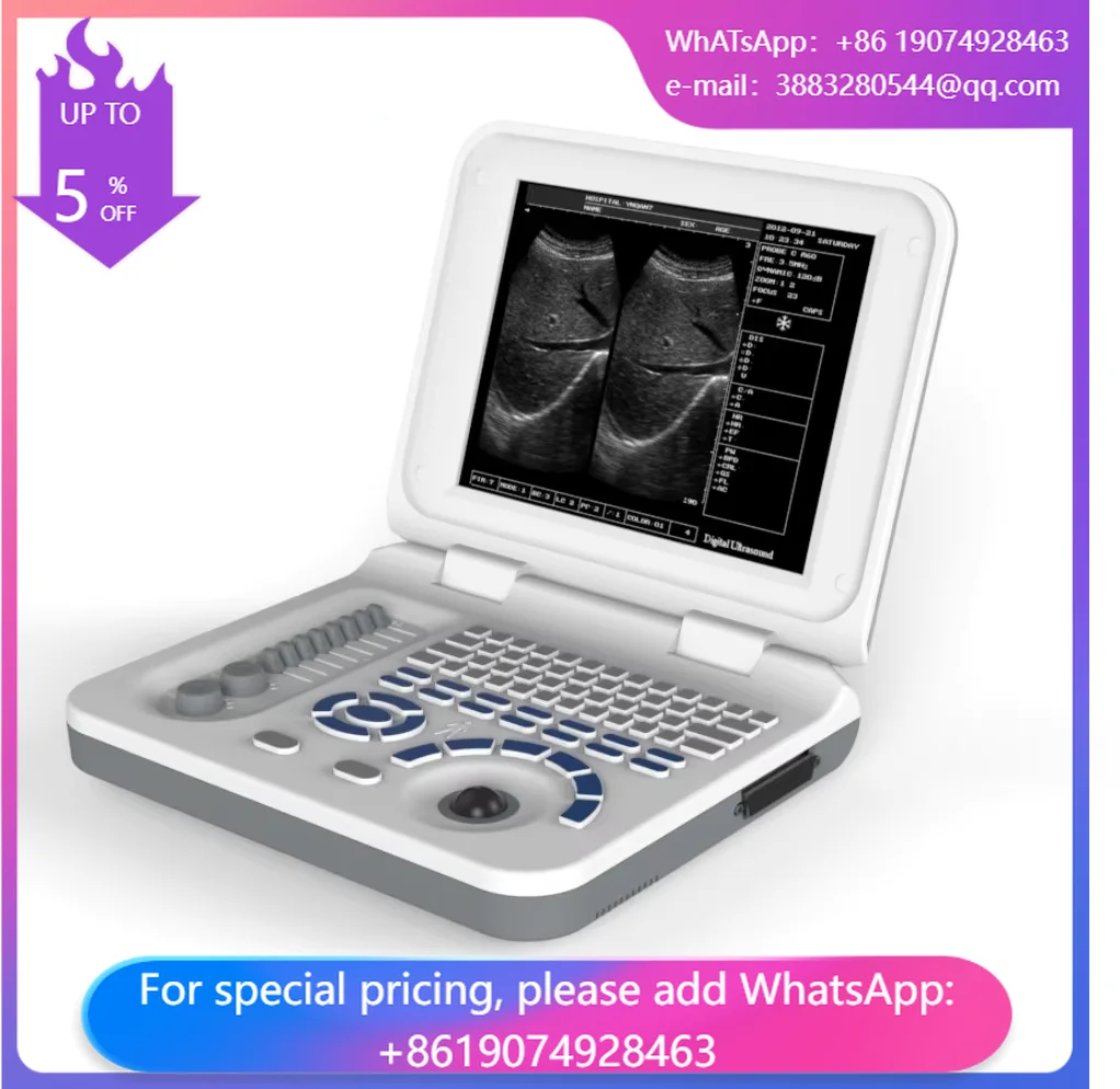 Veterinary Ultrasound Portable Black And White Ultrasound Scanner 10 Inches With 3.5 MHz Convex Probe