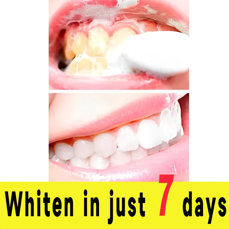 

7 Day Teeth Whitening Powder Efficient Teeth Cleaning Oral Care Breath Cleaning Stain Removal Fresh Breath Tooth Powder