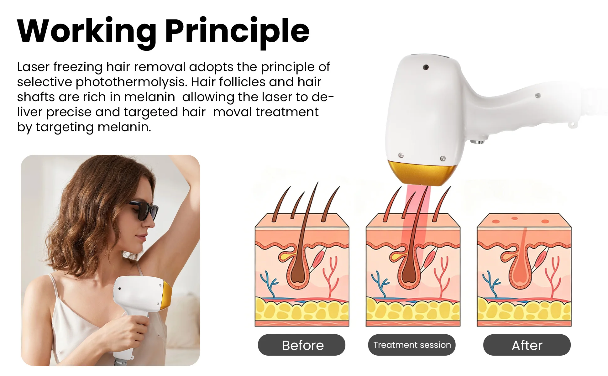 Professional 5000W Diode 10 Target Hair Removal Device, Ice Titanium Painless 3 Wavelength High-power Beauty Equipment