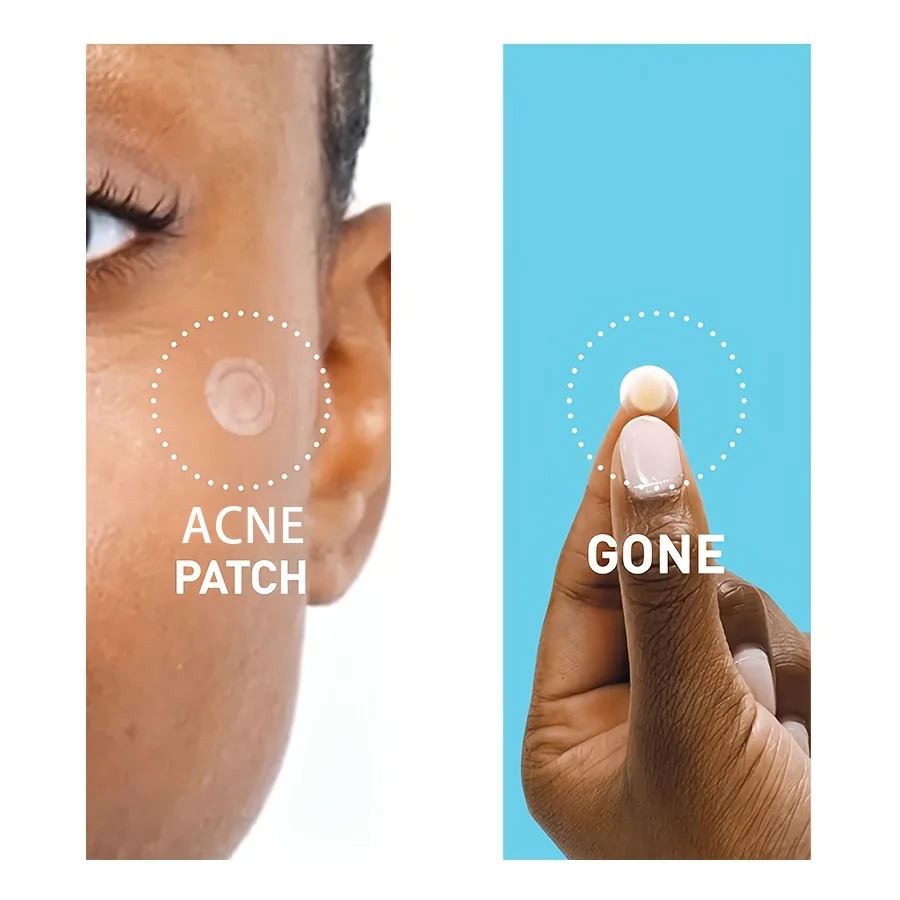 228 قطعة من رقعة حب الشباب غير المرئية ذات الغروانية المائية غير المهيجة، بدون بقايا أو تغطية عيب، لطيفة وغير مهيجة #3