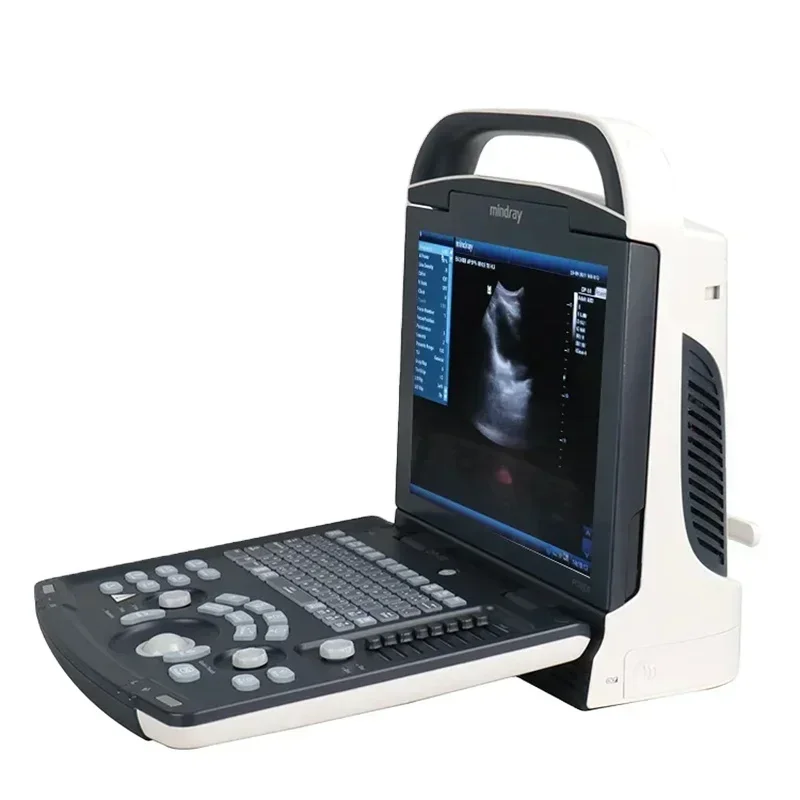 Mindray DP 10 Ultrasound Machine Laptop Mindray Ultrasound Portable Ultrasound Machine