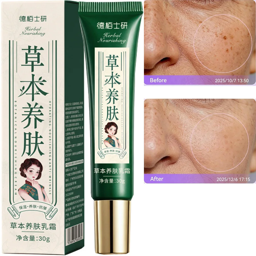 Powerful Spot-Removing Whiten Cream Brighten Skin Fast Eliminates Melanin Pigmentation Melasma Dark Spots Korean Face Skin Care