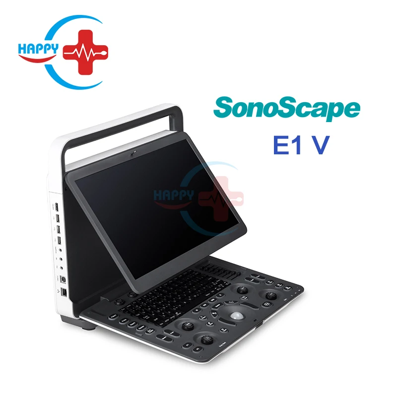 New Black & White Portable Veterinary Ultrasound Machine /Sonoscape E1v /Portable Ultrasound