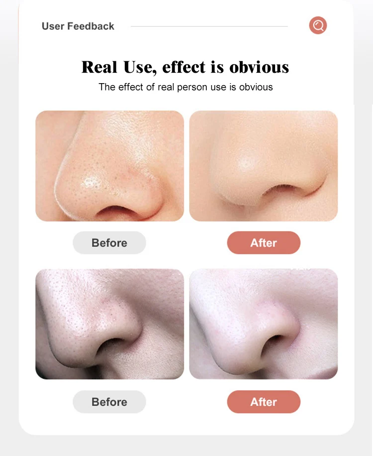 مكتبة ذكية منتجات دروبشيبينغ 2025 تقشير جلدي مائي صغير أكوا الوجه فقاعة صغيرة مزيل الرؤوس السوداء الكهربائية Vac #5