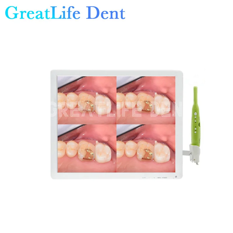 GreatLife 17 Inch Dental Unit Type PIP USB Oral Camera Intraoral Intraoral Camera Monitor Intra Oral Camera Auto Focus