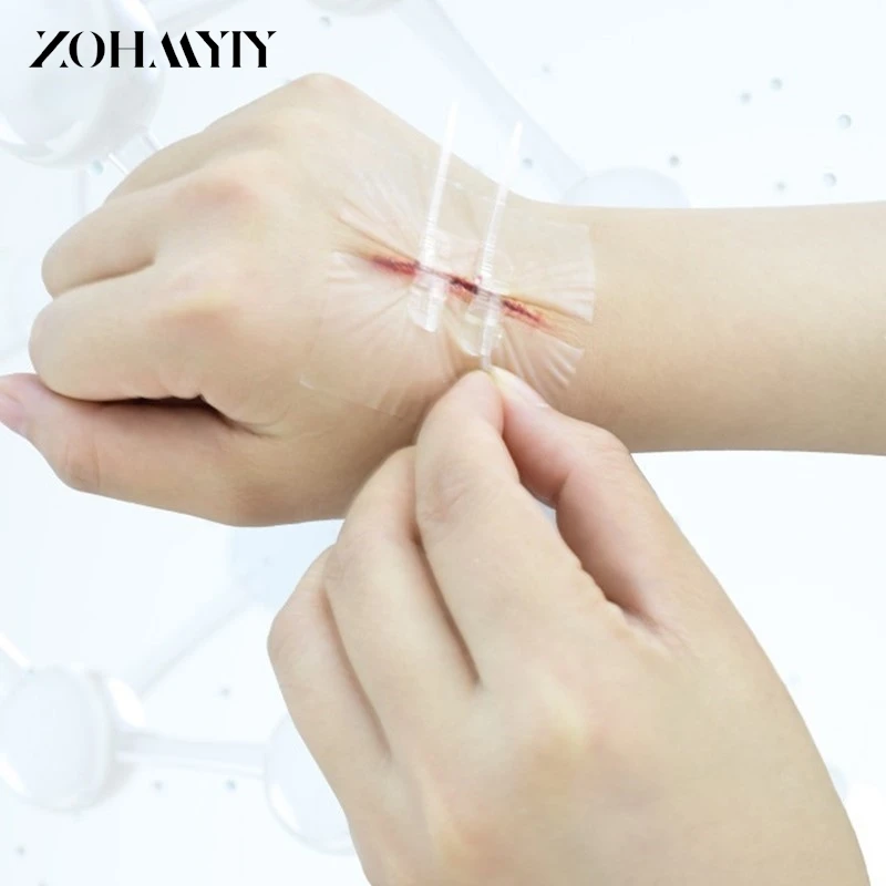 1/2/10Pcs Zipper Tie Wound Closure Patch Hemostatic Patch Wound Fast Suture Zipper Band-Aid Outdoor Portable Skin Care