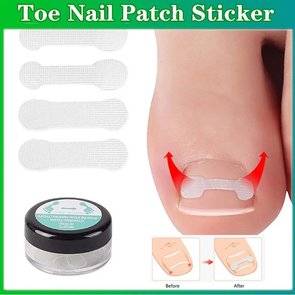 Strumenti patch per Pedicure adesivo per correzione ortesi compresse per la correzione delle unghie adesivo Ortho per unghie dei piedi adesivi per unghie incarnite