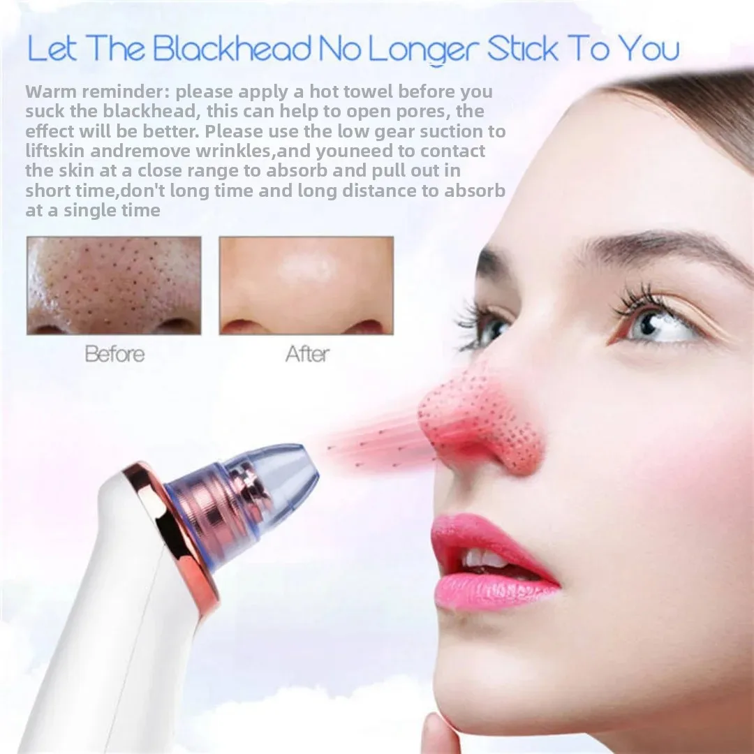 Elektrische Facial Comedondrukker Vacuüm Pore Cleaner Acne Cleanser Zwarte Vlekken Verwijderen Gezicht Neus Diepe Reiniging Gereedschap