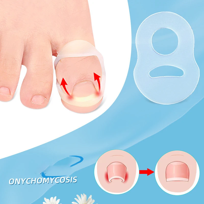 1/2pcs Silicone Ingrown Toenail Correction Tool Invisible Ingrown Toe Nail Straightening Protector Brace Pedicure Feet Care Tool