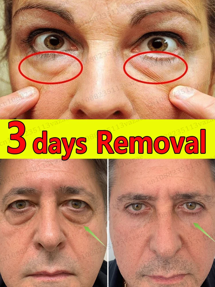 

Никаких об проблемах о области вокруг глаз.