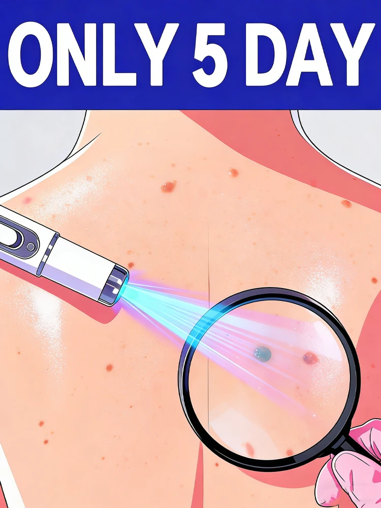 

Средство от пигментных пятен на шее с синим светом, наносится утром и вечером для защиты здоровья, хит продаж, инструменты для ухода за бородавками