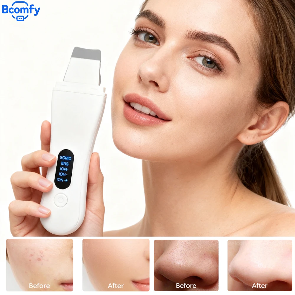 超音波スキンスクラバーショベルスパチュラディープクリーニング黒ずみ毛穴縮小美容機器ピーリングマシンフェイシャルポアクリーナー