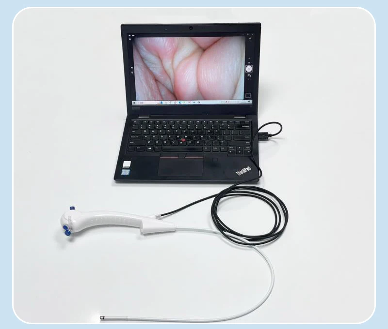 유연성 내시경, 일회용 기관지경, 기관지경/방광경/요관경, 1.95-5.5mm