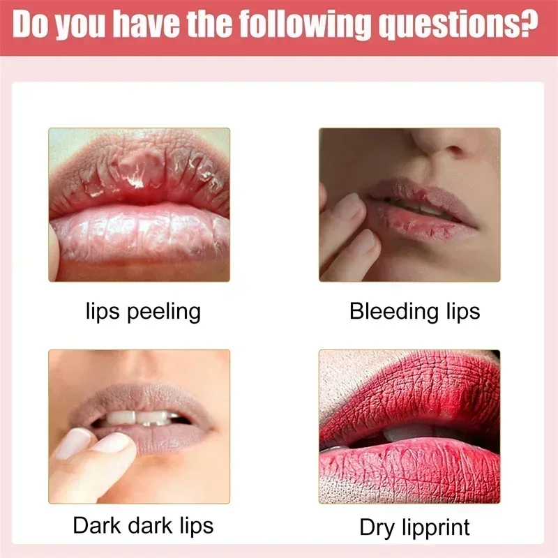 Remove Dark Lip Balm Lightening Melanin Mask Gloss Oil Exfoliating Clean Moisturizer Korean Care Products Makeup Beauty Health