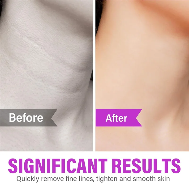 30 Rullo per il viso in pietra di germanio, strumento per il massaggio del viso per il sollevamento, il rafforzamento e l'imbottigliamento della pelle, rullo per il viso antiproiettile-A58E