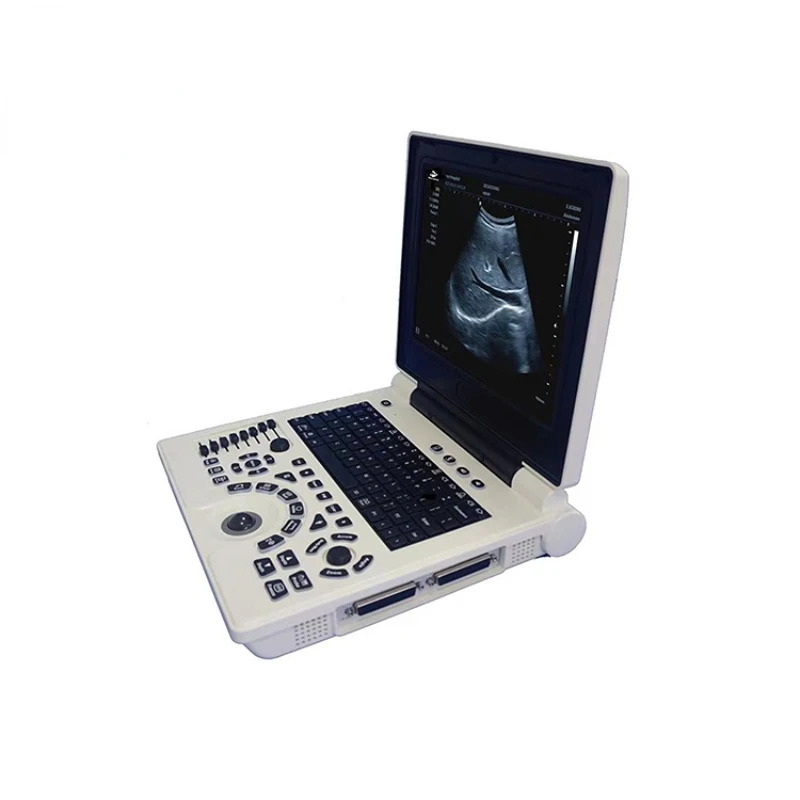 Bioevopeak Laptop type Ultrasound Machine Ultrasound Machine